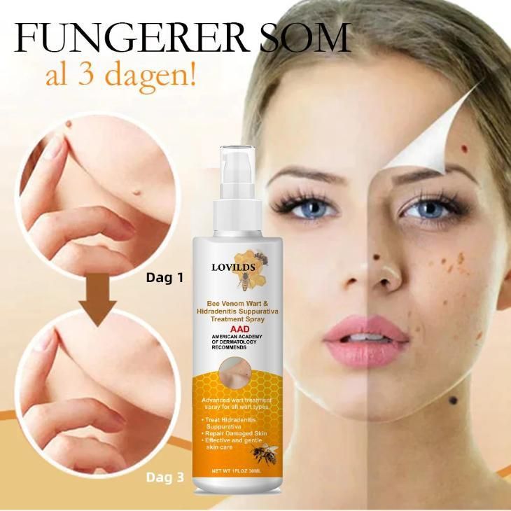 Bee Venom Wart and Skin Tag Remover Spray