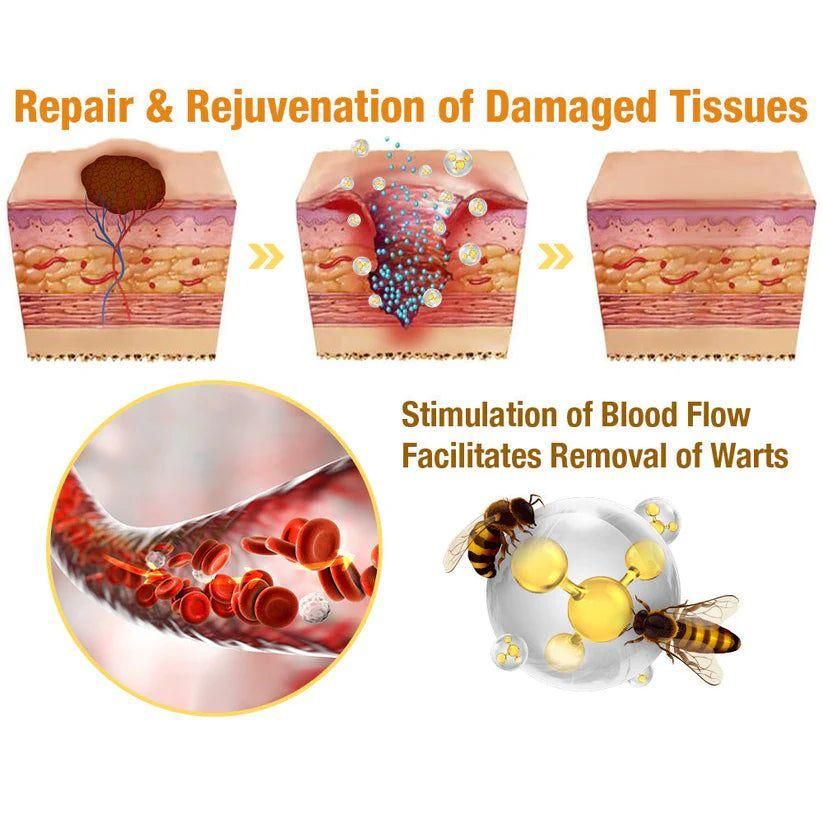 Bee Venom Wart and Skin Tag Remover Spray