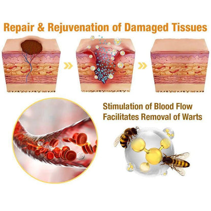 Bee Venom Wart and Skin Tag Remover Spray