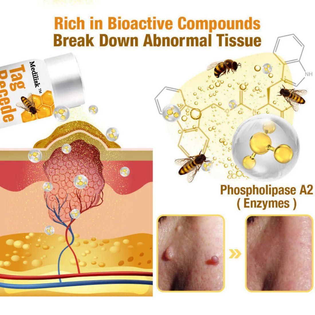 Bee Venom Wart and Skin Tag Remover Spray